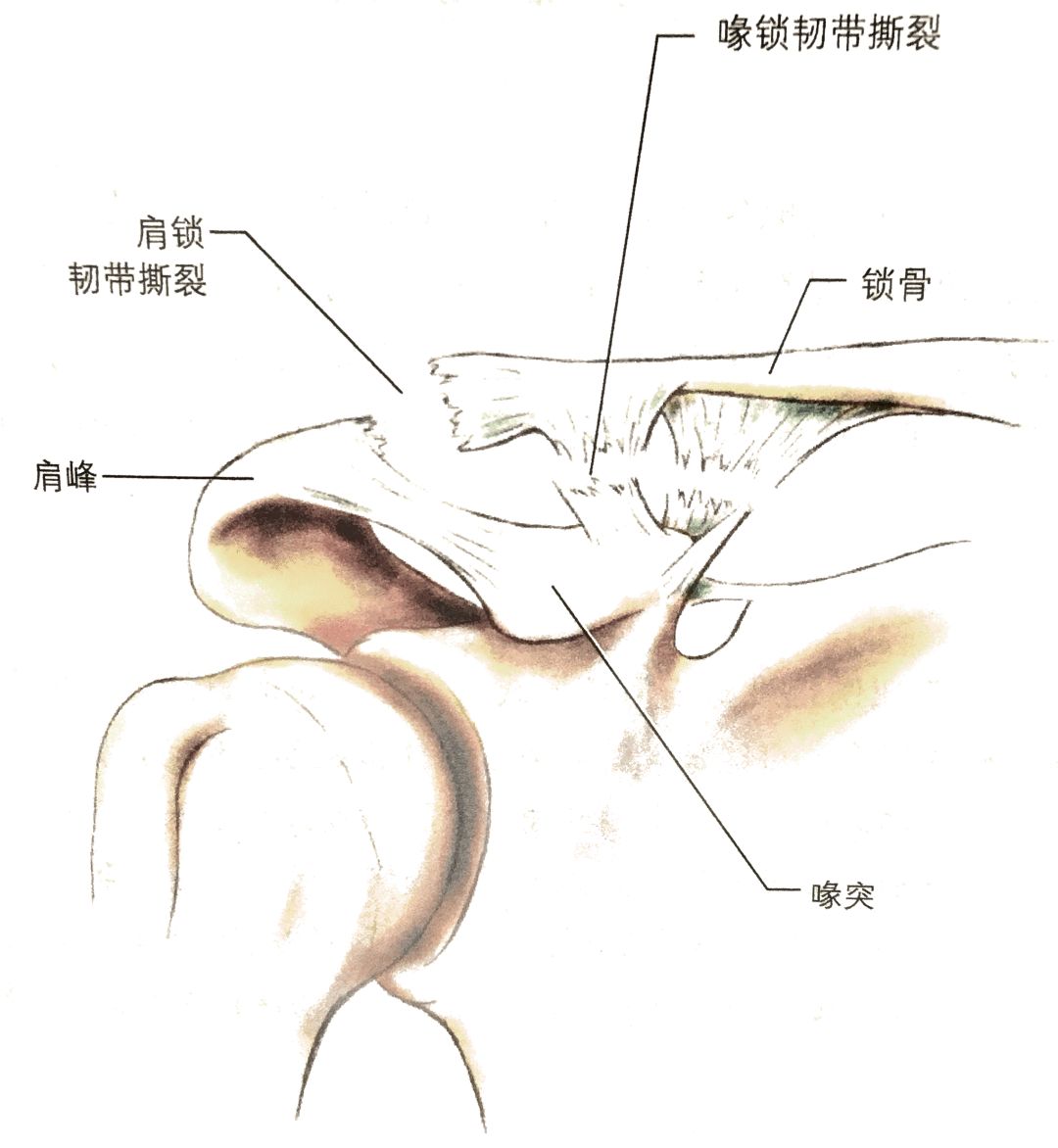 联盟式橄榄球规则_联盟式橄榄球比赛时间_橄榄球联合队