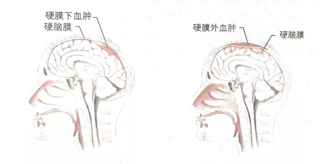 联盟式橄榄球规则_联盟式橄榄球比赛时间_橄榄球联合队