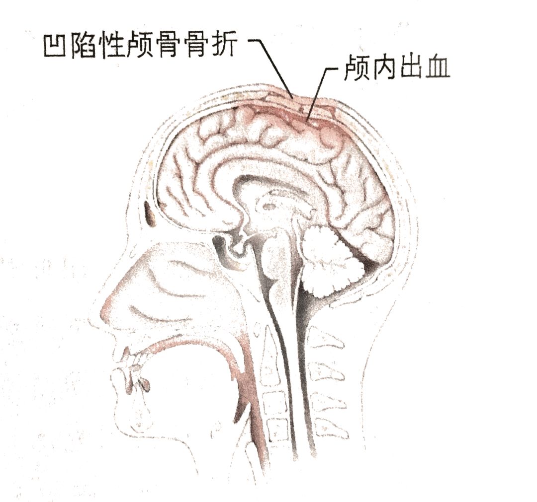 橄榄球联合队_联盟式橄榄球比赛时间_联盟式橄榄球规则