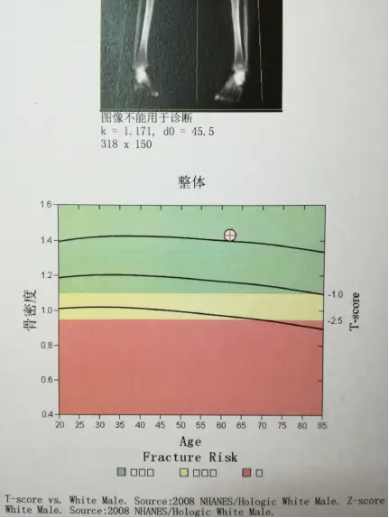 篮板球决定比赛的胜负_篮板规则_篮板球为什么是决定比赛胜负的重要因素之一